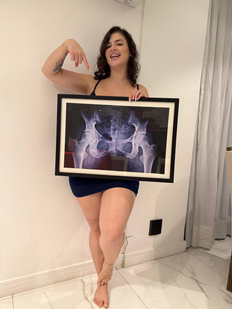 Brazilian influencer Kerolay Chaves, 24, framed an X-ray of her butt to prove her curves are natural, silencing surgery rumors ahead of the Miss BumBum 2025 pageant.